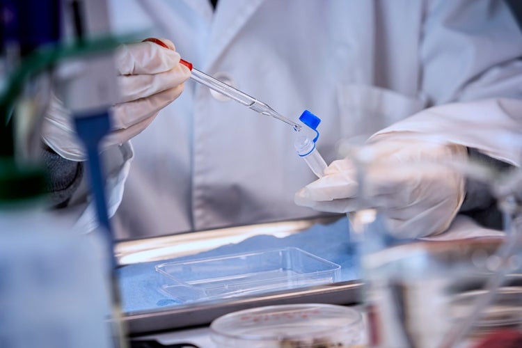 scientist uses a pipette to measure out fluid in a lab