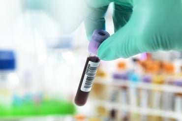 gloved hand handles a vial of blood in a lab setting